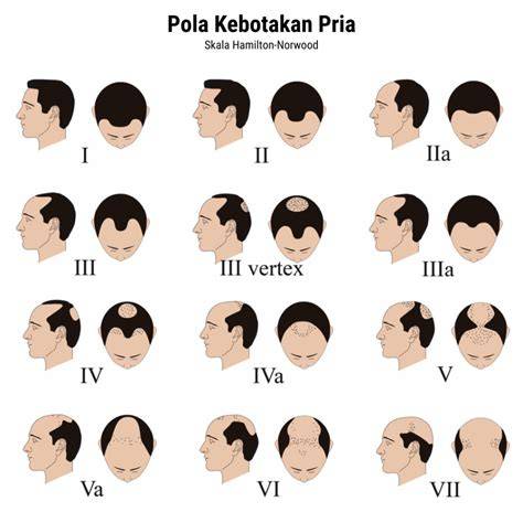 Sertifikat, penghargaan, tanda, atau dokumen yang dipajang di CaRa MeMuAsKaN LaKi LaKi Cek kebotakan 241 streaming 4K lancar lagu populer