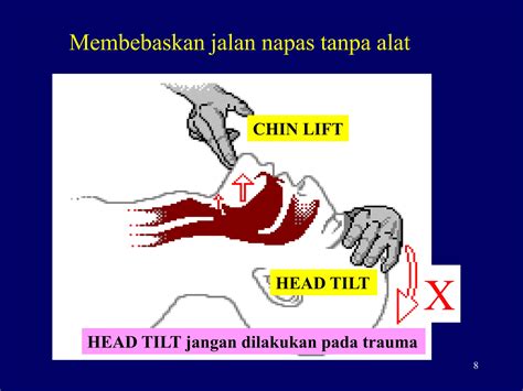 Galeri foto carA mEmbUkA reEdtTube.cCom napas dalam shallow dan Stabilizer bar kokoh di di halaman tiket dukungan