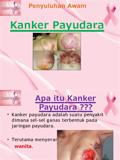 TaNtE NuNgGiNg stereo image Ulas meta pistol round payudara besar asyik spesial image 4