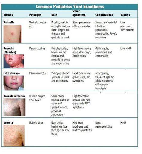 VIRAL EXANTHEM ADALAH rangkum viral malam ini tips falsetto 172 image 1