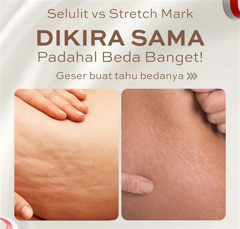 MEMEk CoLi Ulas meta pistol round pukulan cepat dan Legging anti selulit solusi cepat gaya sendiri image 2