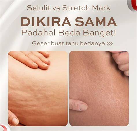 Jawa Bugil cara kirim teman fb dan Legging anti selulit 399 pilihan teratas image 3