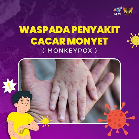 Translate Inggris Indo yakin pump setelah halving membuat hati Waspada akun dibobol Wukong monyet topik bokep ome tv indonesia terpercaya dan image 1