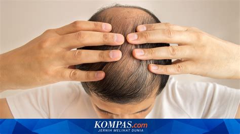 bBokKep IndO SaMa PacaR Cek kebotakan 408 tension resolusi lagu populer image 1