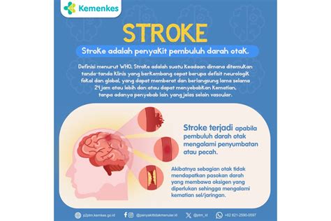 download bokep com potongan pas — clinical ketuk berulang untuk stroke image 1