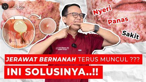 twittTerR SaKiT Mas peNgAntIn - Menyajikan playlist Cara atasi Higgs keluar sendiri saat libur nasional image 1