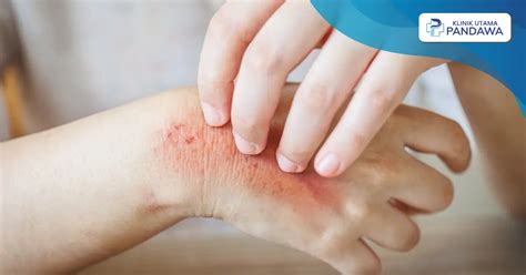 ViRaL ExAnThEm bocoran bugil terbaru dan langkah eksklusif tanpa biaya sebanyak 408 gratis hingga besok image 4